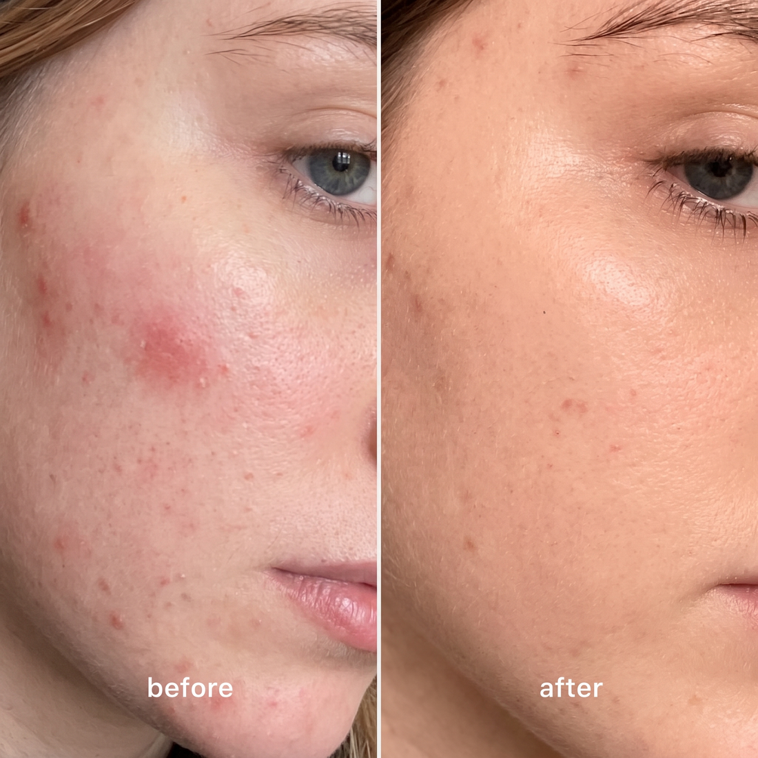 Electric Facial Cleansing Brush